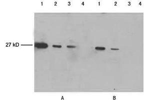 Lane 1-3: 100 ng, 25 ng, 10 ng GFP fusion proteinLane 4: Negative controlPrimary antibody: A. (GFP Antikörper)
