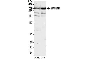 Western Blotting (WB) image for anti-Spectrin Beta, Non-Erythrocytic 1 (SPTBN1) (AA 2100-2150) antibody (ABIN7454694) (SPTBN1 Antikörper  (AA 2100-2150))