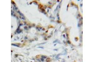 Used in DAB staining on fromalin fixed paraffin-embedded Pancreas tissue (CST6 Antikörper  (AA 29-149))