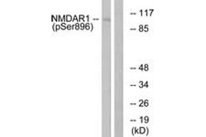 Western blot analysis of extracts from K562 cells treated with PMA 125ng/ml 30', using NMDAR1 (Phospho-Ser896) Antibody. (GRIN1/NMDAR1 Antikörper  (pSer897))