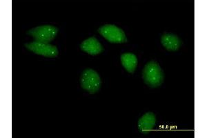 Immunofluorescence of purified MaxPab antibody to NSMCE2 on HeLa cell. (NSMCE2 Antikörper  (AA 1-247))