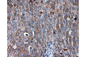 Immunohistochemical staining of paraffin-embedded liver tissue using anti-CD36 mouse monoclonal antibody. (CD36 Antikörper)