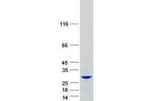 Validation with Western Blot (CBX1 Protein (Transcript Variant 1) (Myc-DYKDDDDK Tag))