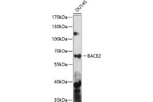 Western blot analysis of extracts of DU145 cells, using B antibody (ABIN7265880) at 1:1000 dilution. (BACE2 Antikörper  (AA 240-470))