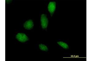 Immunofluorescence of purified MaxPab antibody to RECQL5 on HeLa cell.