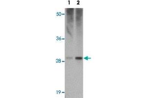 Western blot analysis of HVCN1 in human spleen tissue lysate with HVCN1 polyclonal antibody  at (1) 0. (HVCN1 Antikörper  (C-Term))