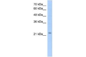 EMP2 antibody used at 1. (EMP2 Antikörper  (Middle Region))