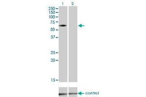 Western blot analysis of IRAK3 over-expressed 293 cell line, cotransfected with IRAK3 Validated Chimera RNAi (Lane 2) or non-transfected control (Lane 1). (IRAK3 Antikörper  (AA 497-596))