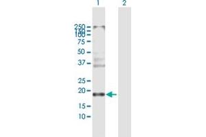 Western Blot analysis of CLDN8 expression in transfected 293T cell line by CLDN8 MaxPab polyclonal antibody.