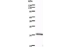 Western Blotting (WB) image for anti-LIM Domain Only 1 (Rhombotin 1) (LMO1) antibody (ABIN932474) (LMO1 Antikörper)