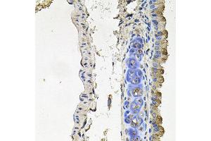 Immunohistochemistry of paraffin-embedded mouse lung using NDUFA6 antibody at dilution of 1:100 (x40 lens). (NDUFA6 Antikörper)