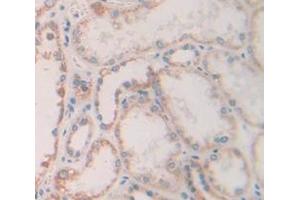 IHC-P analysis of Human Tissue, with DAB staining. (FGF13 Antikörper  (AA 63-245))