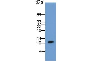 Detection of S100B in Rat Cerebrum lysate using Polyclonal Antibody to S100 Calcium Binding Protein B (S100B) (S100B Antikörper  (AA 1-92))
