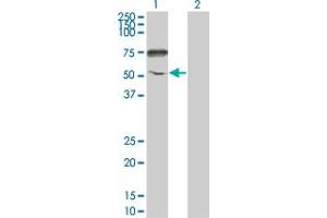 Western Blot analysis of ENPP5 expression in transfected 293T cell line by ENPP5 monoclonal antibody (M01), clone 1C5-1D7. (ENPP5 Antikörper  (AA 24-477))