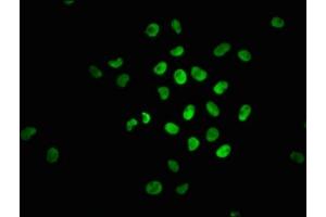 Immunofluorescence staining of Hela cells with ABIN7127720 at 1:100,counter-stained with DAPI. (Rekombinanter NRF2 Antikörper  (pSer40))