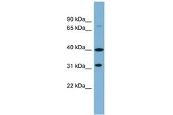 Ferric-Chelate Reductase 1 Like (FRRS1L) (AA 215-264) Antikörper
