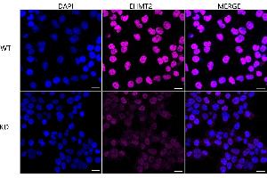 Immunocytochemical staining of HeLa cells using EHMT2 antibody (ABIN7797609), 1:1,000), Top panel: wild-type (WT), Bottom panal: EHMT2 shRNA knockdown (KD). (Rekombinanter EHMT2 Antikörper)