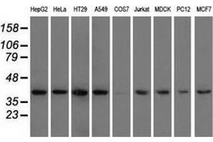 Western blot analysis of extracts (35 µg) from 9 different cell lines by using anti-HIBCH monoclonal antibody. (HIBCH Antikörper)