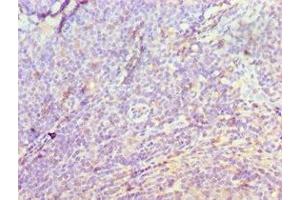 Immunohistochemistry of paraffin-embedded human tonsil tissue using ABIN7149566 at dilution of 1:100 (DIDO1 Antikörper  (AA 1-300))