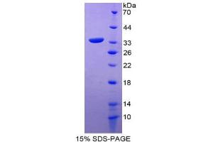 SDS-PAGE (SDS) image for Sodium Hydrogen Exchange Regulatory Cofactor 2 (AA 56-326) protein (His tag) (ABIN2127154) (Sodium Hydrogen Exchange Regulatory Cofactor 2 (AA 56-326) protein (His tag))