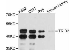 Western blot analysis of extracts of various cell lines, using TRIB2 antibody (ABIN5999100) at 1:3000 dilution. (TRIB2 Antikörper)