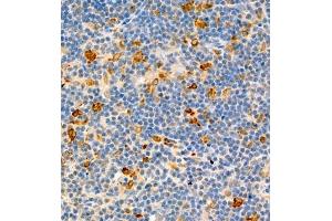 Immunohistochemistry of paraffin embedded rat thymus using MHC-II (ABIN7074245) at dilution of 1:1800 (400x lens) (CD74 Antikörper)