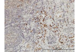Immunoperoxidase of monoclonal antibody to CSE1L on formalin-fixed paraffin-embedded human tonsil. (Exportin 2 Antikörper  (AA 872-971))