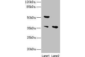 Western blot All lanes: IMPACT antibody at 10 μg/mL Lane 1: Hela whole cell lysate Lane 2: HL60 whole cell lysate Secondary Goat polyclonal to rabbit IgG at 1/10000 dilution Predicted band size: 37, 23 kDa Observed band size: 37, 52 kDa (IMPACT Antikörper  (AA 41-320))