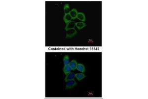ICC/IF Image Immunofluorescence analysis of methanol-fixed A431, using PSMD2, antibody at 1:500 dilution. (PSMD2 Antikörper)