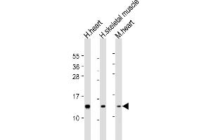 Western Blotting (WB) image for anti-NADH Dehydrogenase (Ubiquinone) Fe-S Protein 6, 13kDa (NADH-Coenzyme Q Reductase) (NDUFS6) (AA 32-65) antibody (ABIN6244090)