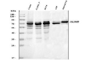 Western blot analysis of NUMB using anti-NUMB antibody (ABIN3043374). (NUMB Antikörper  (N-Term))