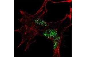 Fluorescent confocal image of SY5Y cells stained with KLF4 antibody at 1:100. (KLF4 Antikörper  (AA 69-101))