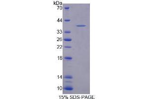 SDS-PAGE (SDS) image for 3-Hydroxymethyl-3-Methylglutaryl-CoA Lyase (HMGCL) (AA 1-325) protein (His tag) (ABIN6239404) (HMGCL Protein (AA 1-325) (His tag))