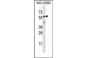 Western blot analysis of ODF2L Antibody (C-term) in NCI-H292 cell line lysates (35ug/lane). (ODF2L Antikörper  (C-Term))