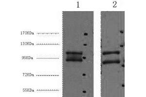Western Blot analysis of 1) Hela, 2) HepG2 cells using IDE Monoclonal Antibody at dilution of 1:2000. (IDE Antikörper)