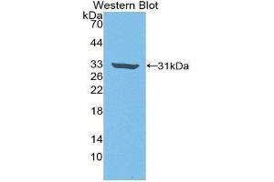 Western Blotting (WB) image for anti-rho-Associated, Coiled-Coil Containing Protein Kinase 2 (ROCK2) (AA 904-1140) antibody (ABIN3205961) (ROCK2 Antikörper  (AA 904-1140))