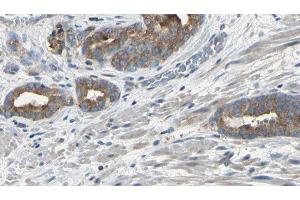 ABIN6275121 at 1/100 staining Human prostate tissue by IHC-P.