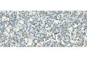 Immunohistochemistry of paraffin-embedded Human tonsil tissue using CCT5 Polyclonal Antibody at dilution of 1:55(x200) (CCT5 Antikörper)