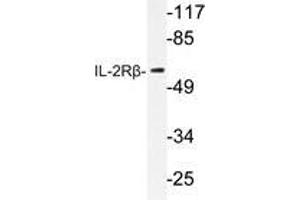 Western blot analysis of IL-2Rβ antibody in extracts from RAW264. (IL2 Receptor beta Antikörper)