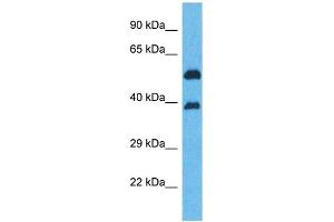 Western Blotting (WB) image for anti-Olfactory Receptor, Family 5, Subfamily K, Member 2 (OR5K2) (Middle Region) antibody (ABIN2791759) (OR5K2 Antikörper  (Middle Region))