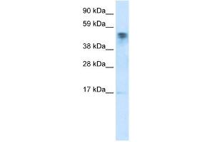 WB Suggested Anti-FLJ13798 Antibody Titration:  0. (FLJ13798 (FLJ13798) (C-Term) Antikörper)