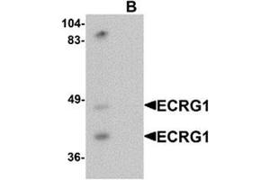 Western blot analysis of ECRG1 in mouse liver tissue lysate with ECRG1 antibody at 1 ug/mL in (A) the absence and (B) the presence of blocking peptide.