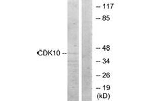 Western Blotting (WB) image for anti-Cyclin-Dependent Kinase 10 (CDK10) (AA 51-100) antibody (ABIN2889602) (CDK10 Antikörper  (AA 51-100))