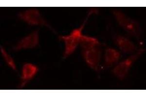 ABIN6275891 staining  HeLa cells by IF/ICC. (NR1I2 Antikörper  (Internal Region))