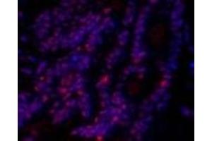 Immunofluorescence analysis of Rat lung tissue using SIRT1 Polyclonal Antibody at dilution of 1:200. (SIRT1 Antikörper)