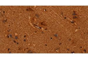 Immunohistochemistry of paraffin-embedded Human brain tissue using ALG11 Polyclonal Antibody at dilution 1:40 (ALG11 Antikörper)