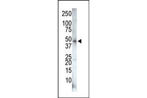 Image no. 1 for anti-Phosphatidylinositol-5-Phosphate 4-Kinase, Type II, gamma (PIP4K2C) (C-Term) antibody (ABIN360486)