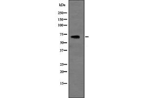 Western blot analysis of SLC6A3 expression in HEK293 cells ,The lane on the left is treated with the antigen-specific peptide. (SLC6A3 Antikörper  (Internal Region))
