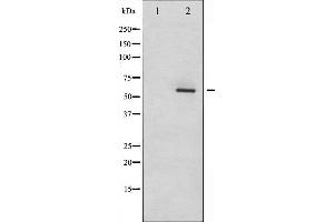 Western blot analysis of Dab1 phosphorylation expression in LOVO whole cell lysates,The lane on the left is treated with the antigen-specific peptide. (DAB1 Antikörper  (pTyr232))