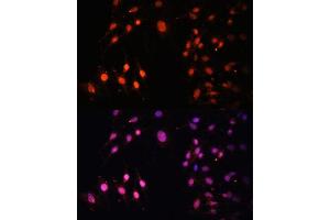 Immunofluorescence analysis of C6 cells using SETD2 Polyclonal Antibody (ABIN3017564, ABIN3017565, ABIN1682666 and ABIN6220156) at dilution of 1:100 (40x lens).